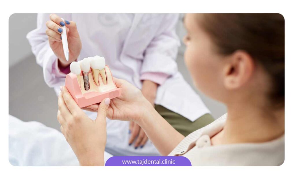 تصویر ماکت دندان و دندانپزشکی که شرایط ایمپلنت دندان را به بیمار خود توضیح می دهد