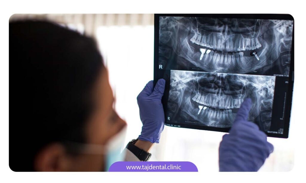 تصویر دندانپزشک در حال چک کردن عکس رادیوگرافی