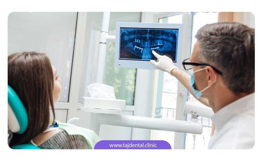 تصویر دندانپزشک در حال دادن توضیحاتی به بیمار از روی عکس opg