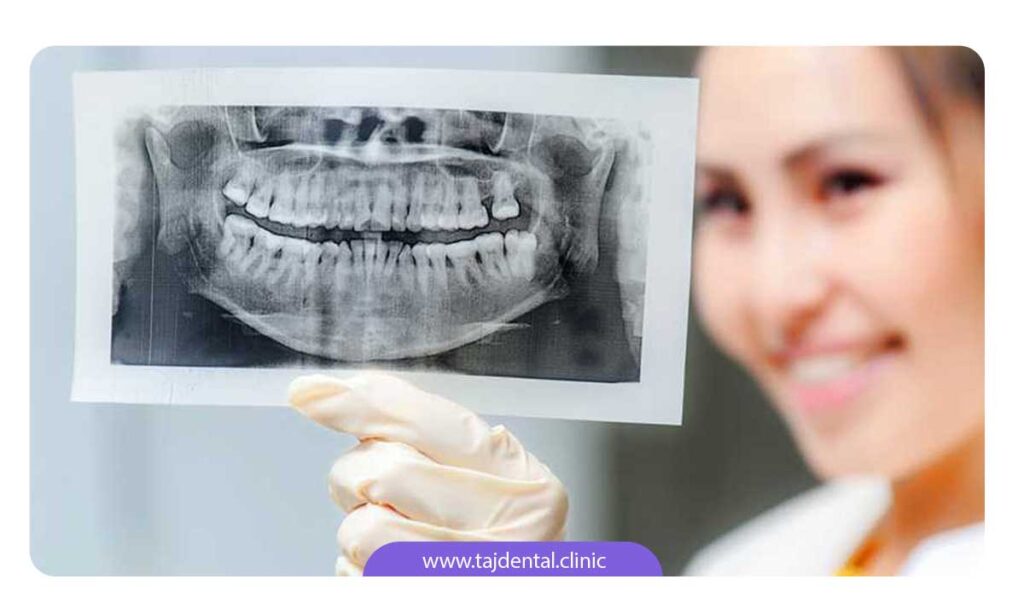 تصویر دندانپزشک در حال مشاهده عکس opg