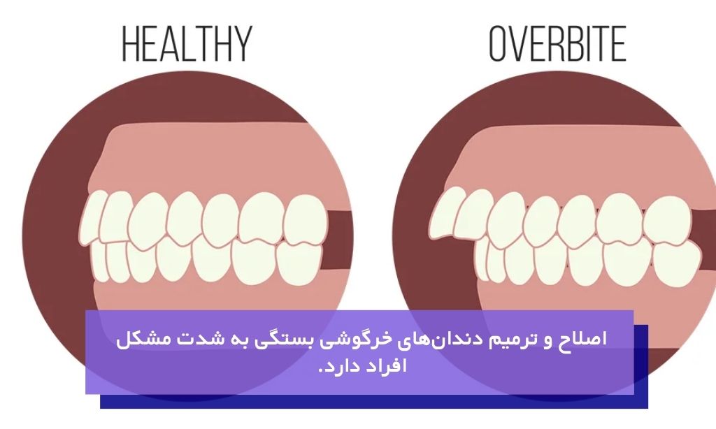 اصلاح و ترمیم دندان‌های خرگوشی