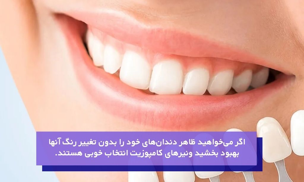 لمینت کامپوزیتی