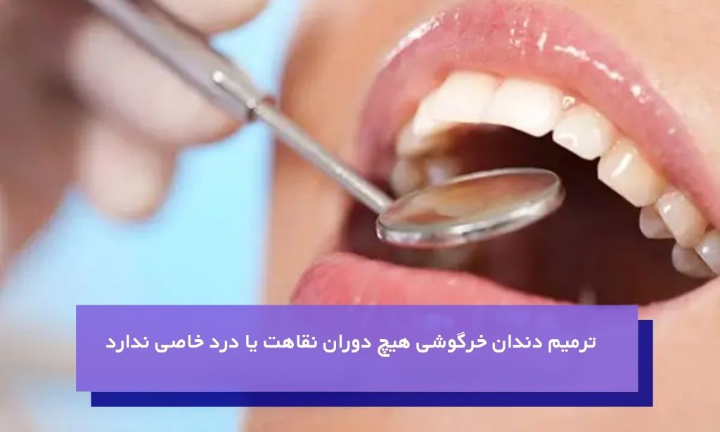 راحتی و سرعت یکی از دلایل مهم در محبوبیت این روش برای اصلاح دندان خرگوشی