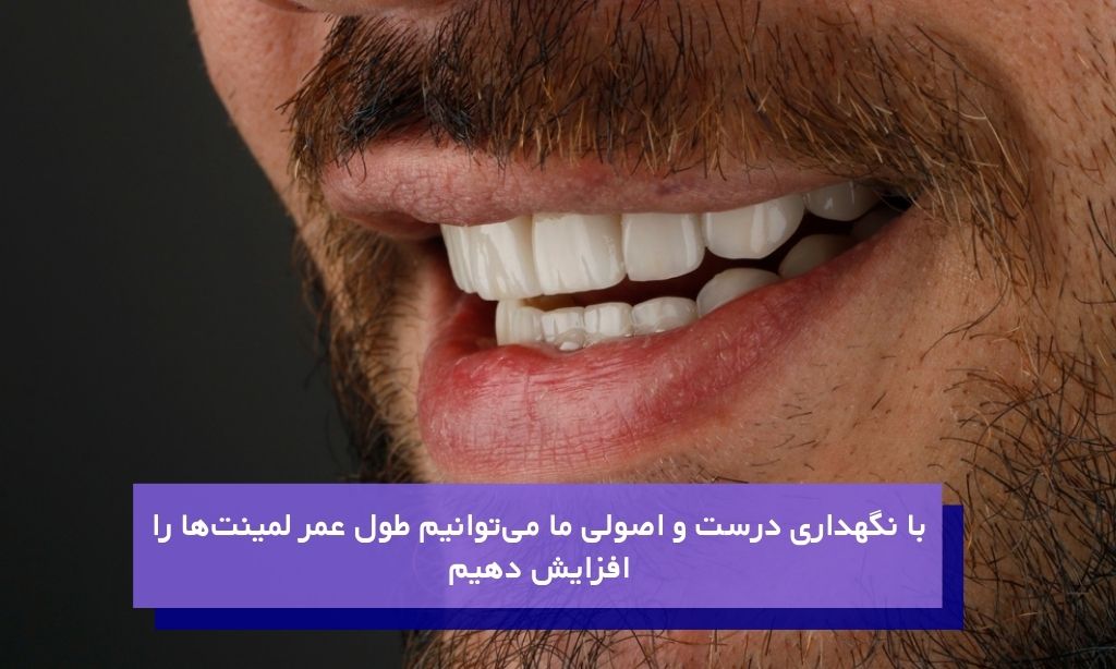 افزایش متوسط طول عمر لمینت دندان