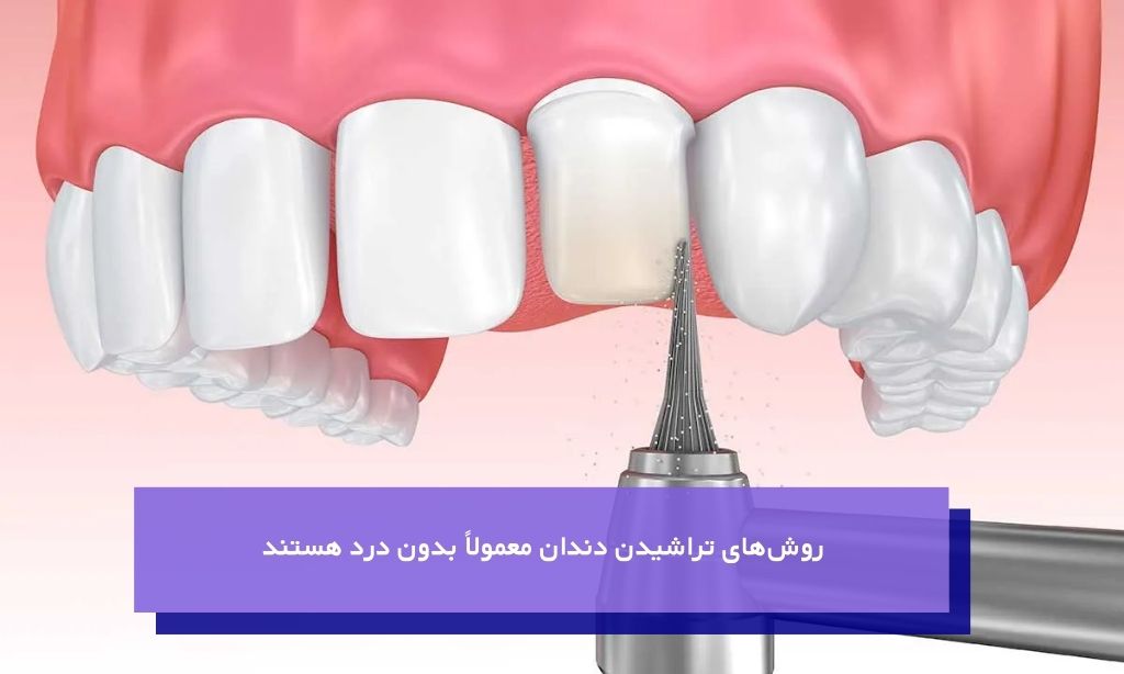 تراش دندان در لمینت درد دارد