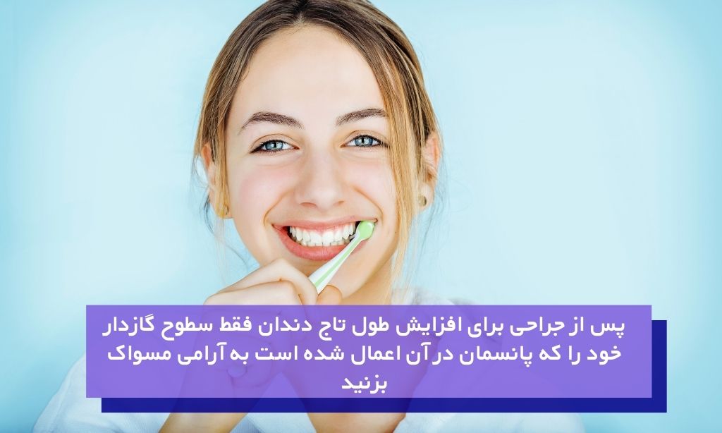 نحوه مسواک زدن پس از جراحی برای افزایش طول تاج دندان