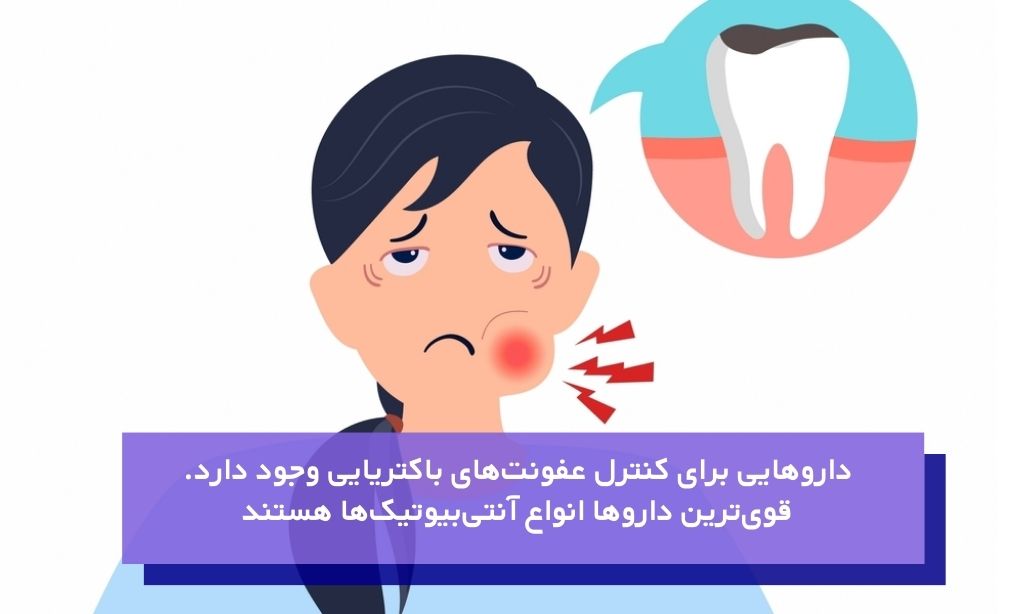 میزان اهمیت آنتی‌بیوتیک‌ها برای عفونت دندان