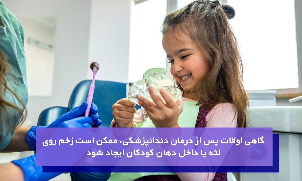 آفت دهان کودکان بعد از دندانپزشکی