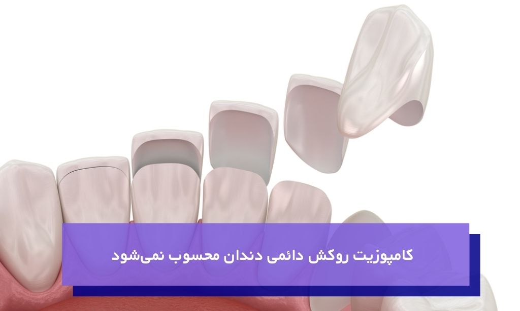 تعویض به موقع کامپوزیت