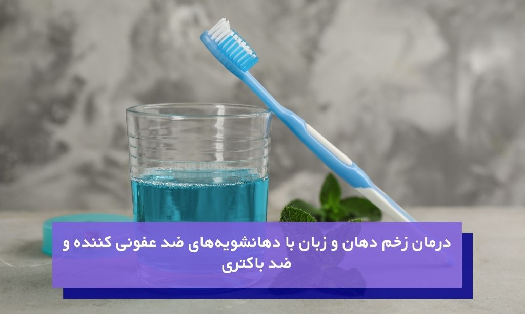 درمان زخم دهان و زبان با دهانشویه ضدباکتری