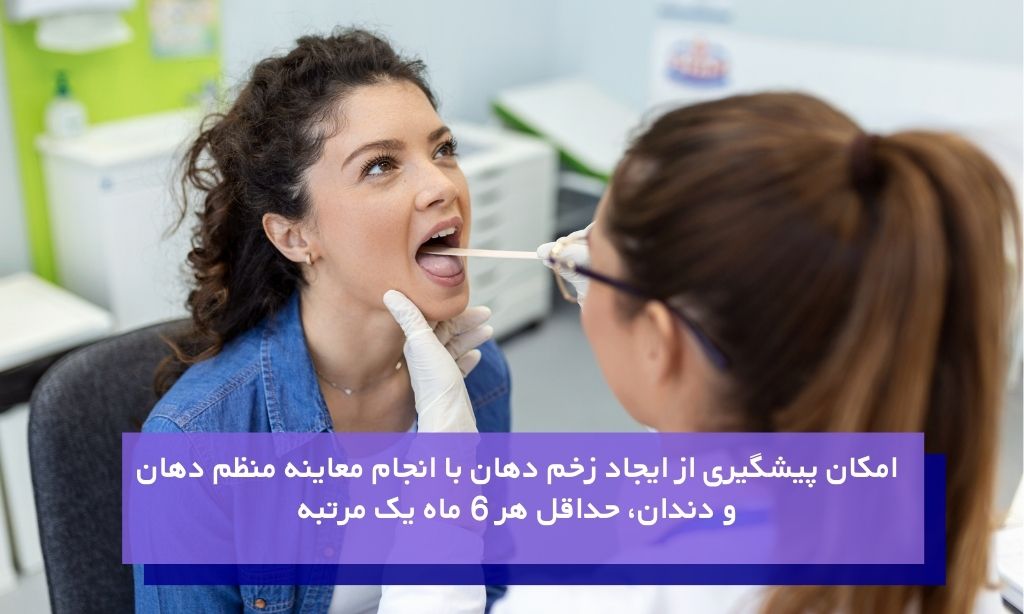 پیشگیری از ایجاد زخم دهان