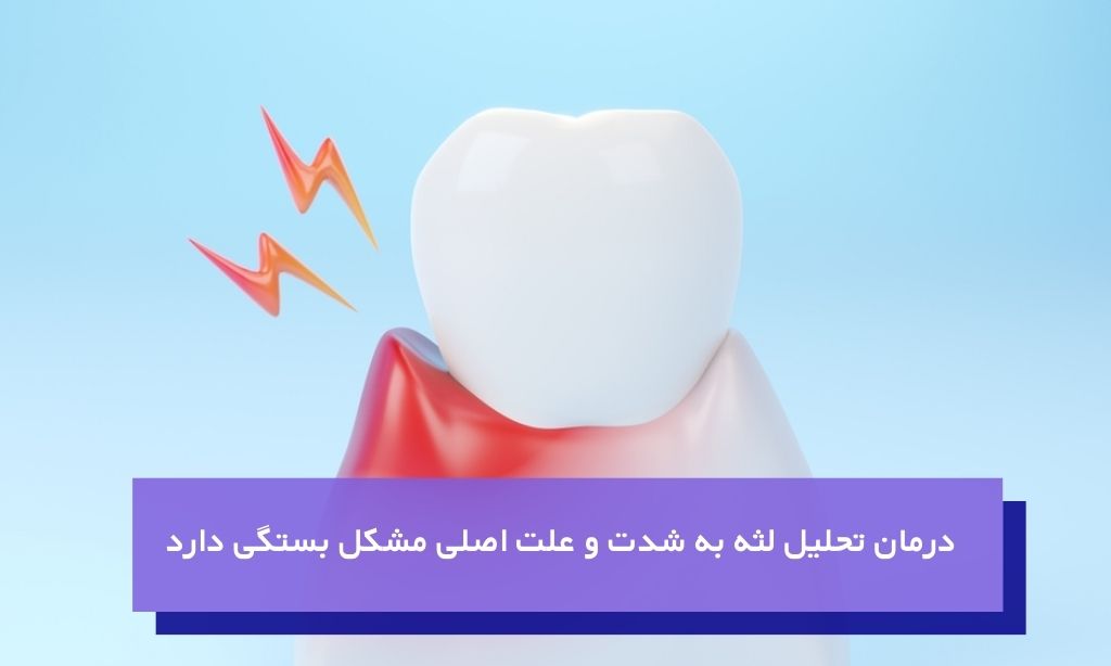 درمان تحلیل لثه