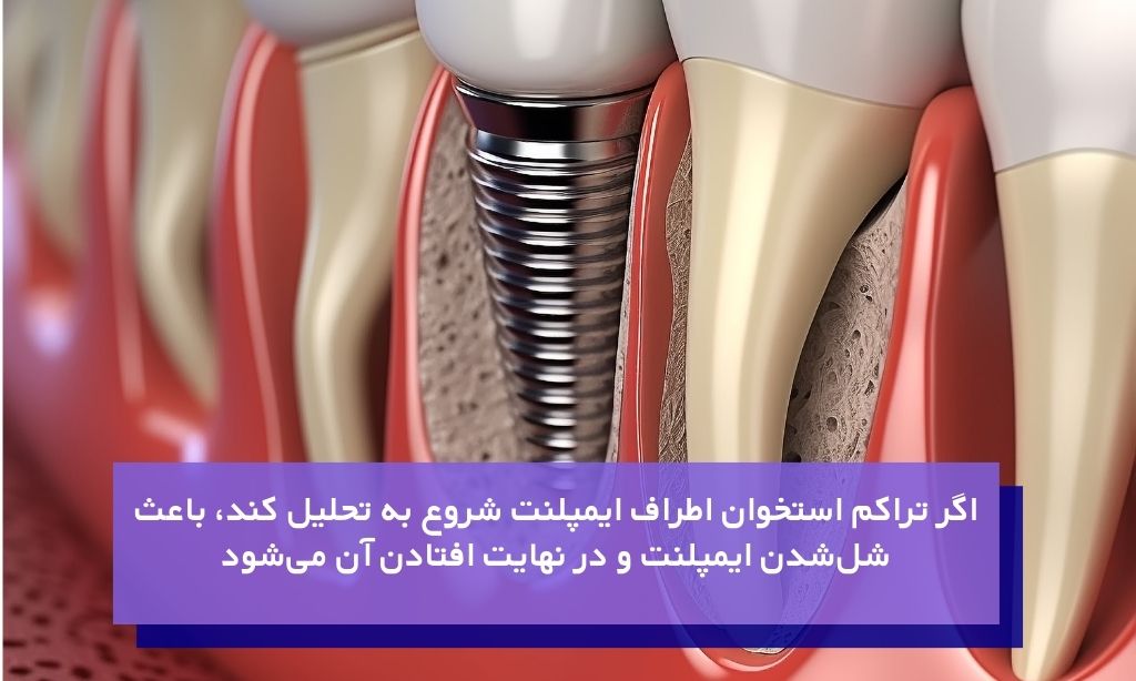 مهمترین دلایل کاهش تراکم استخوان