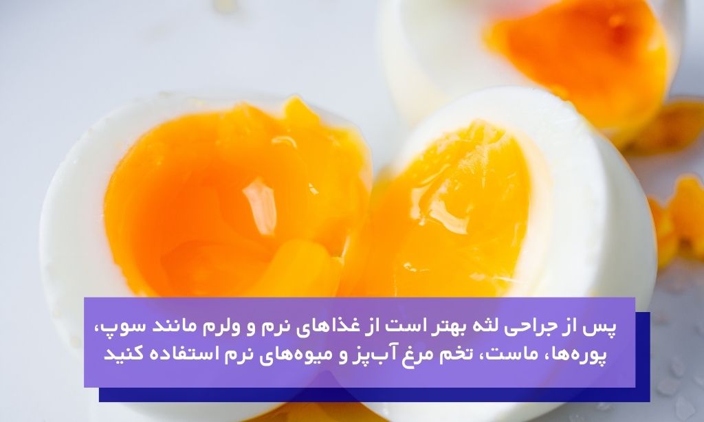 تغذیه مناسب بعد از جراحی لثه