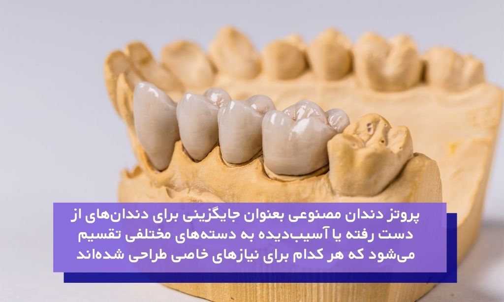 معرفی انواع پروتز دندان