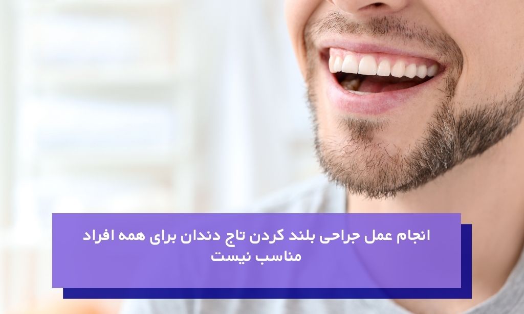 افراد مناسب برای عمل جراحی بلند کردن تاج دندان