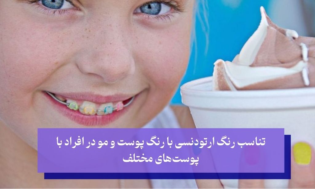 تناسب رنگ ارتودنسی با رنگ پوست و مو