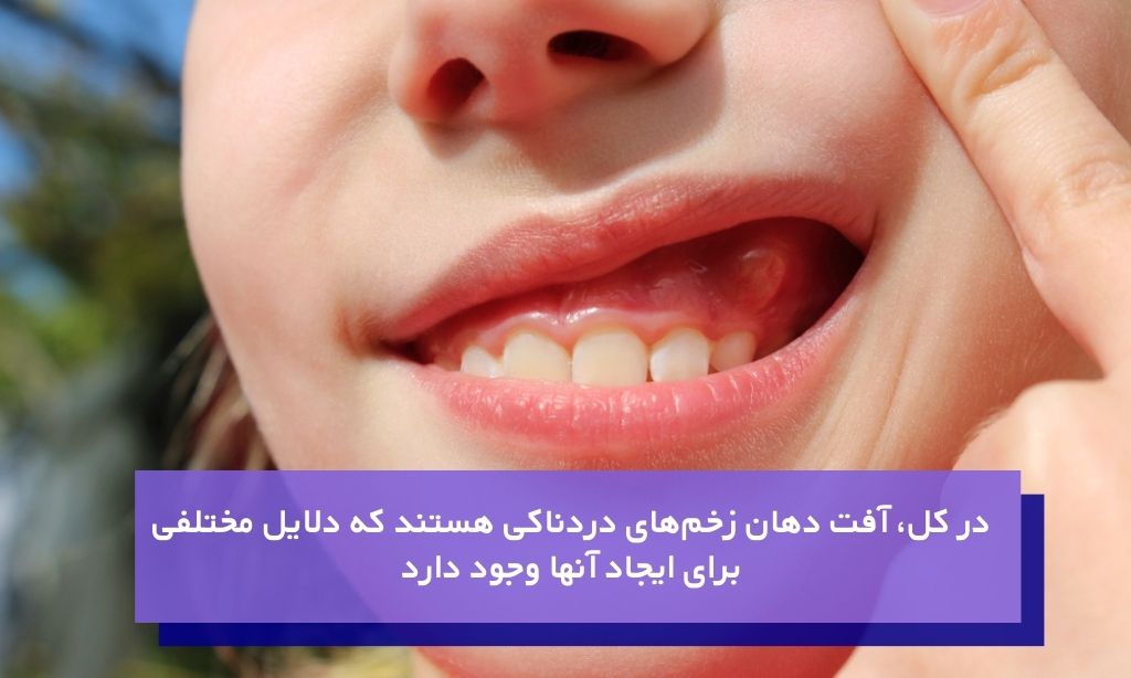 علت دقیق ایجاد آفت دهان