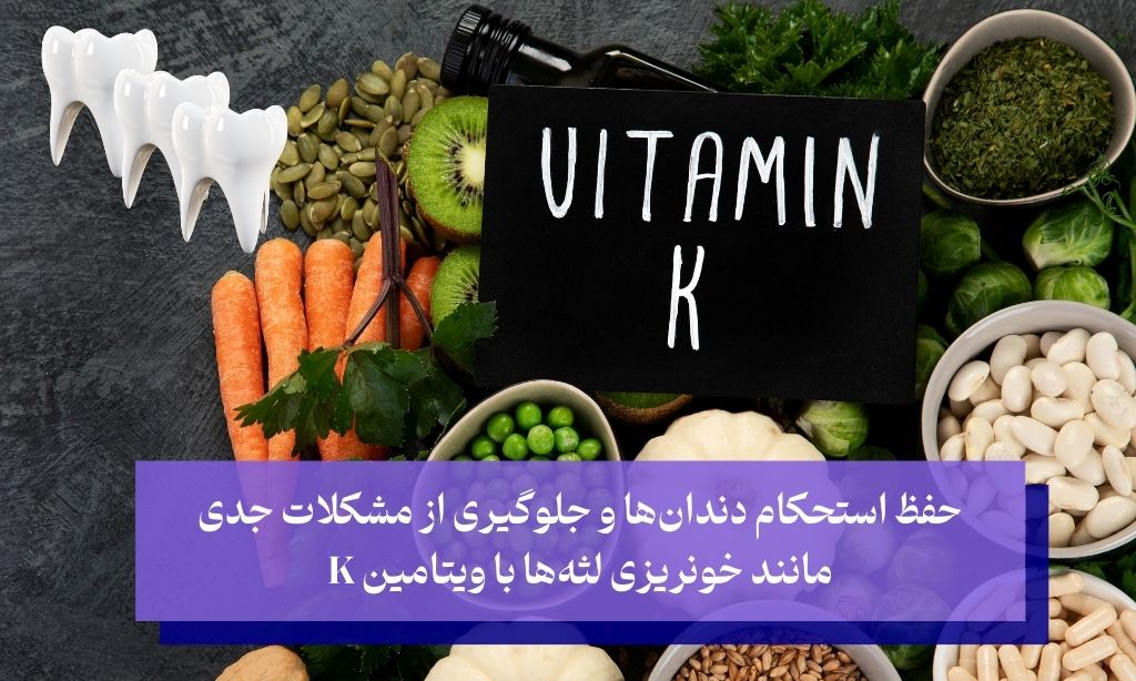 حفظ استحکام دندان‌ها و جلوگیری از مشکلات جدی