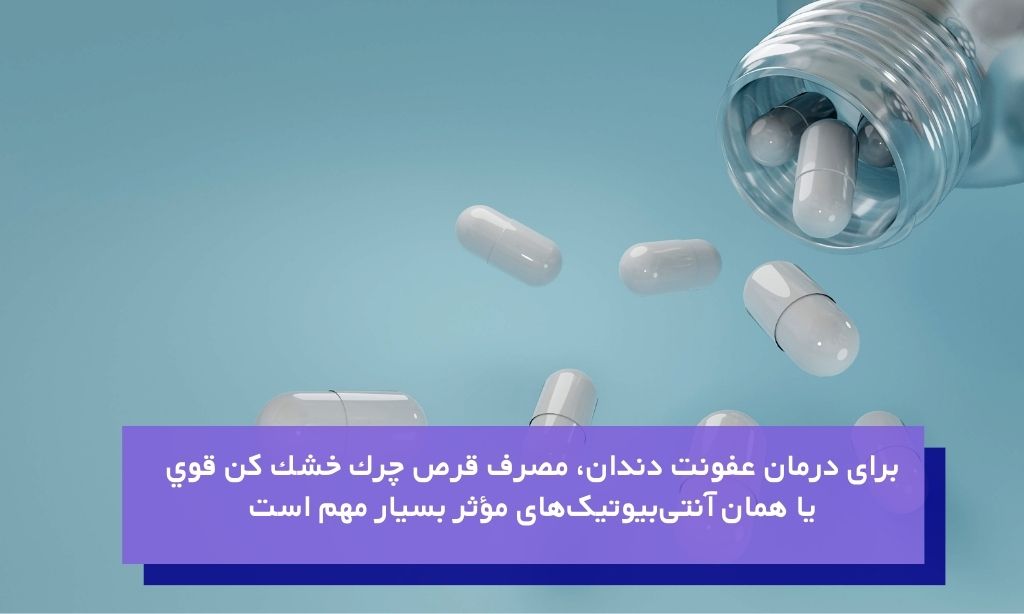 قرص چرک خشک کن برای خارج کردن عفونت دندان