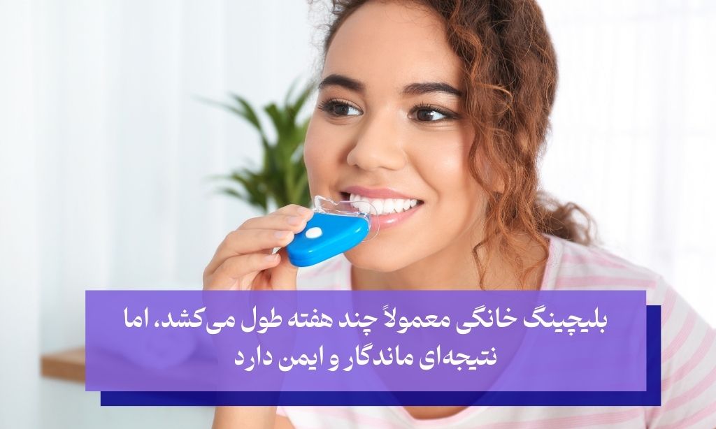 بلیچینگ خانگی سریع ترین روش سفید شدن دندان در خانه