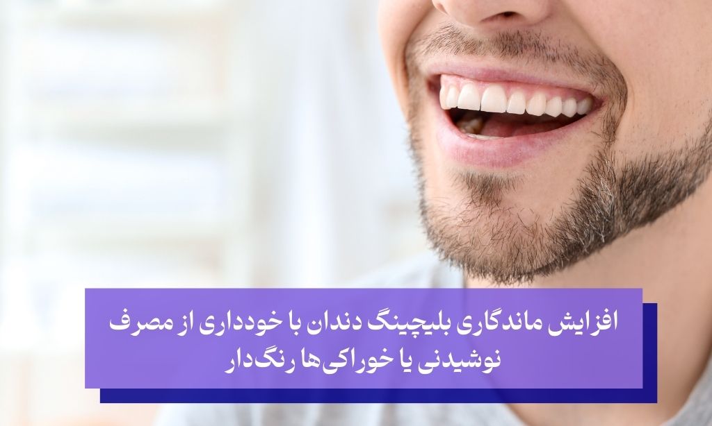 روش‌های افزایش ماندگاری بلیچینگ دندان