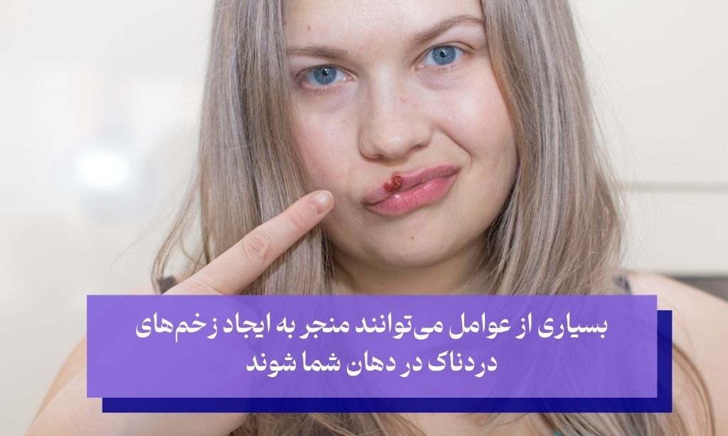 عوامل ایجاد زخم‌های دهانی