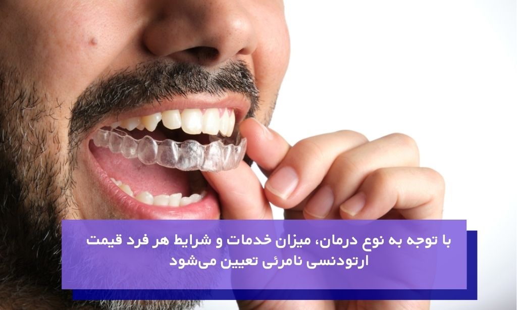 قیمت ارتودنسی نامرئی