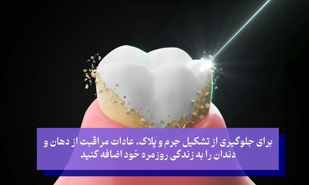 بهترین روش درمان جرم دندان پیشگیری است