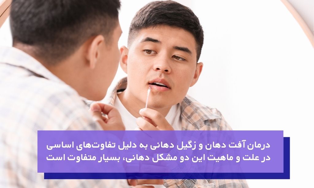 تفاوت آفت دهان با زگیل دهانی در درمان