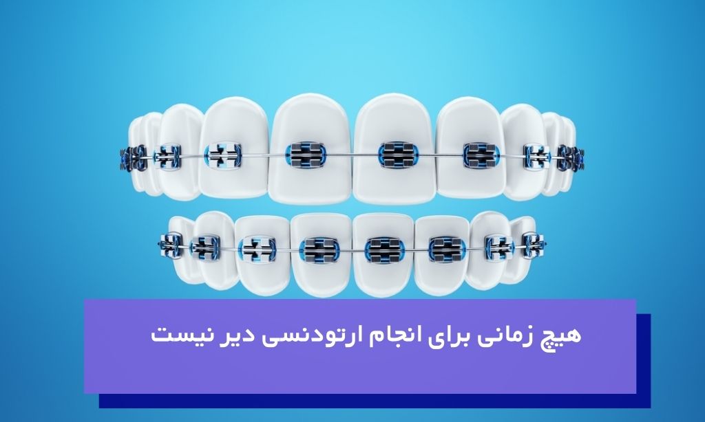 ارتودنسی بزرگسالان