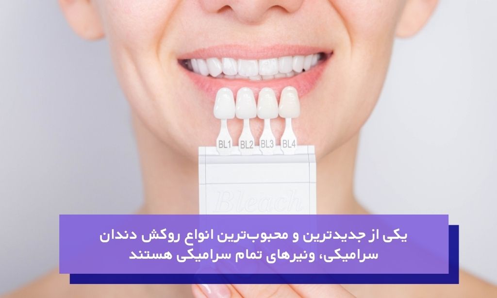 روکش تمام سرامیکی