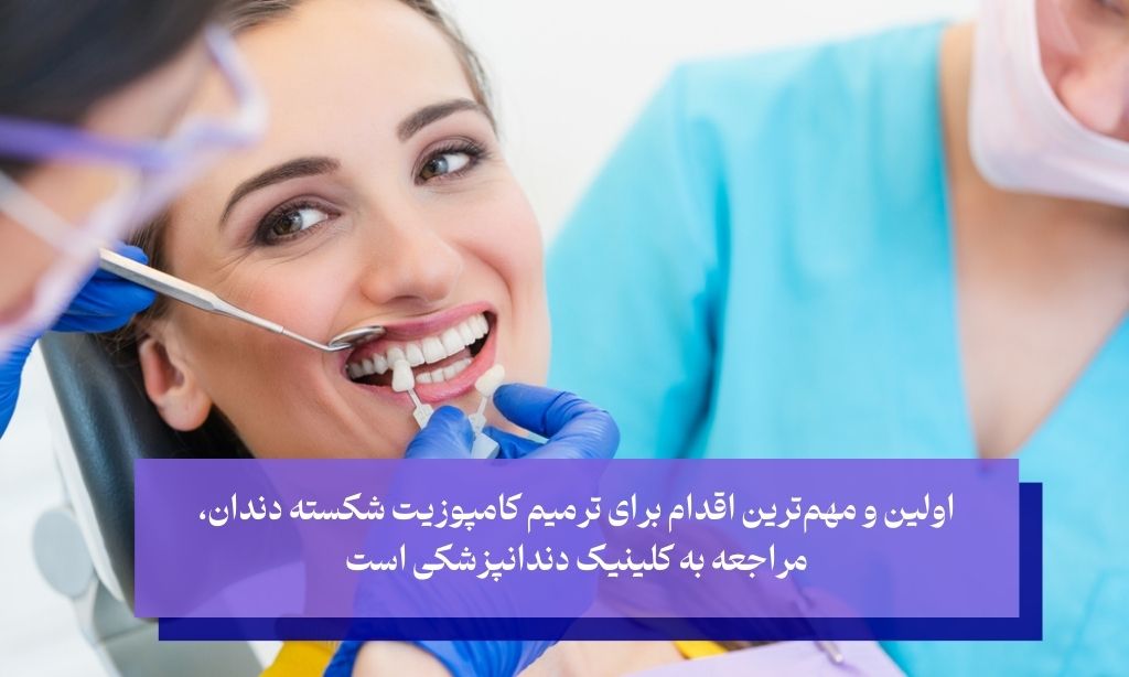 مراجعه به دندانپزشک اولین اقدام برای ترمیم کامپوزیت شکسته 