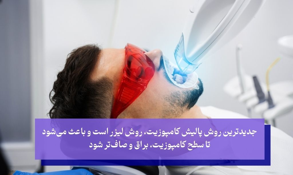 روش پالیش با لیزر