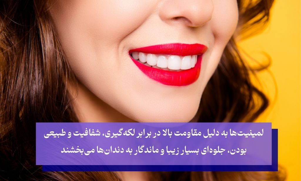 لمینیت دندان یکی از محبوب‌ترین و موثرترین روش‌های زیبایی دندان