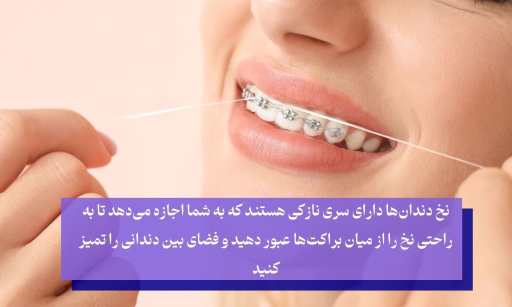 نخ دندان مخصوص ارتودنسی مکملی ضروری برای مسواک