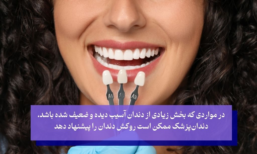 روش‌های درمانی پوسیدگی دندان