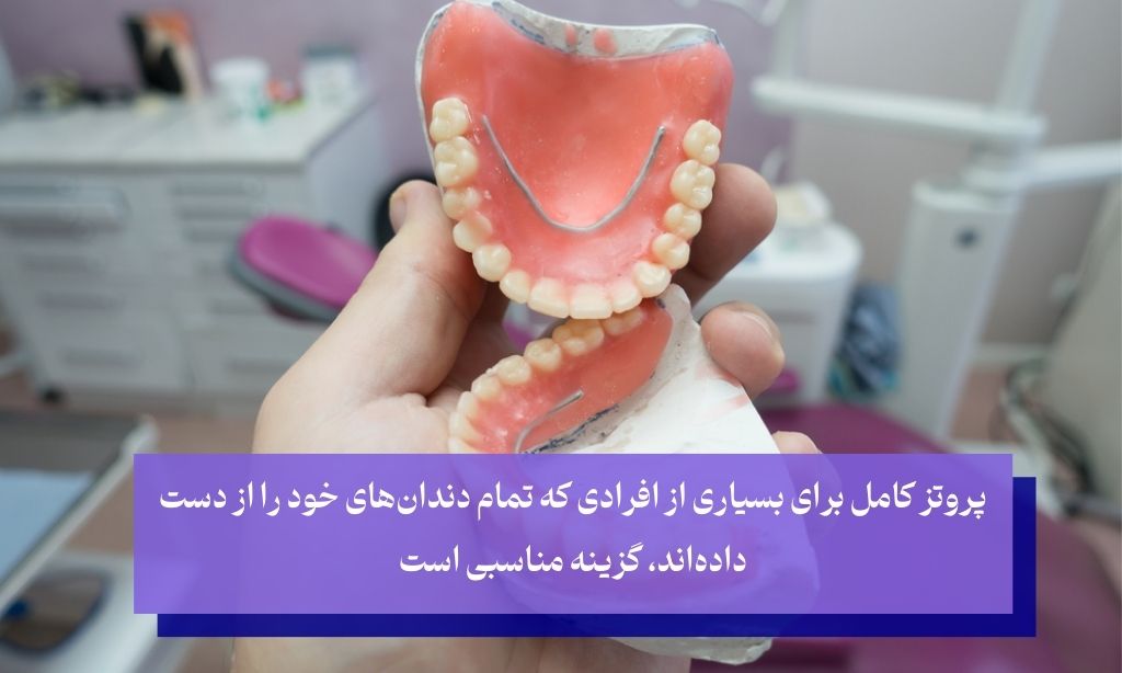 قیمت پروتزهای کامل برای کاشت بدون ایمپلنت