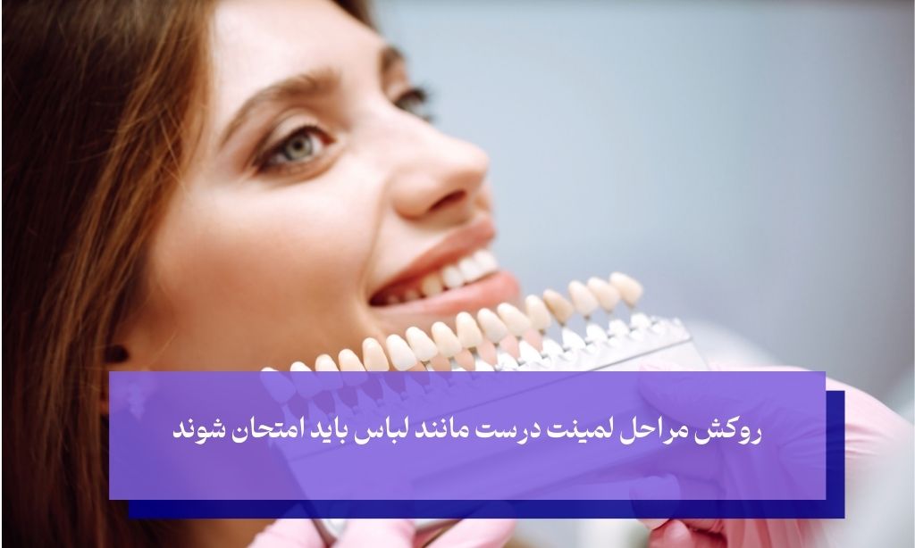 تست زیبایی و تناسب دومین مرحله لیمنت دندان