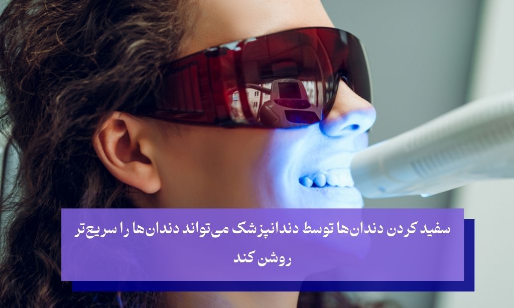 بلیچینگ در مطب دندانپزشکی