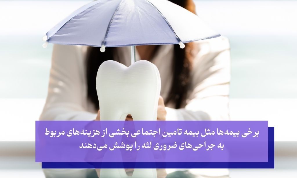 آیا بیمه هزینه جراحی لثه را پوشش می‌دهد