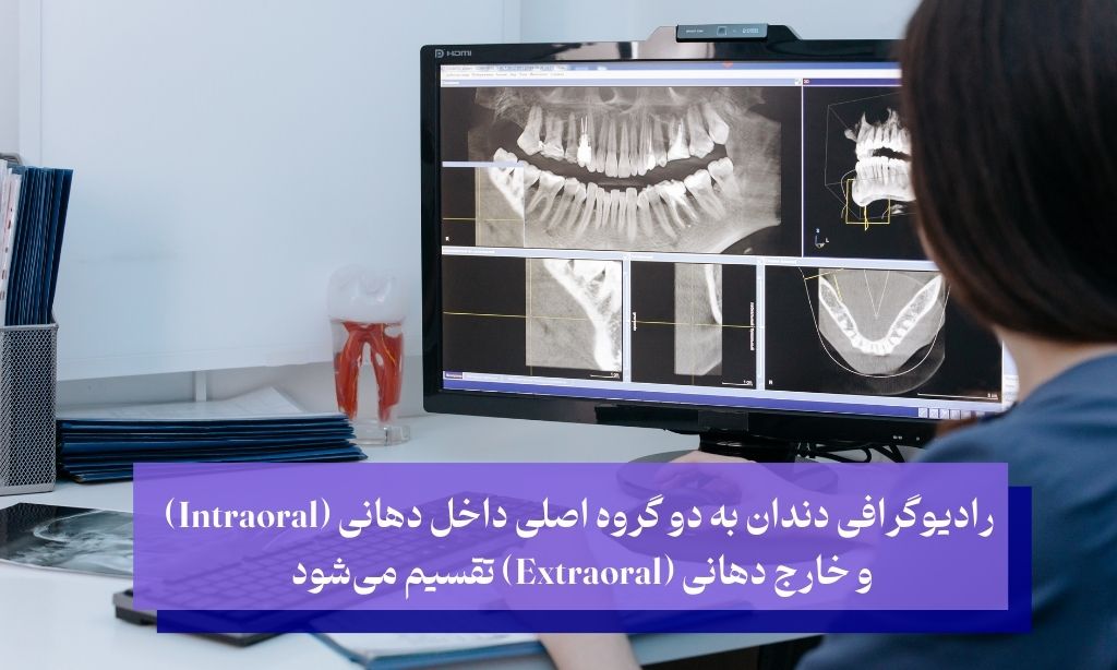 انواع رادیوگرافی دندان