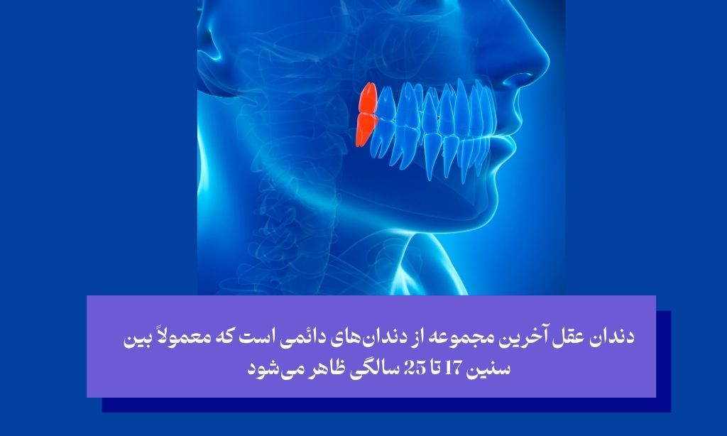 دندان عقل چیست و چرا به جراحی نیاز پیدا می‌کند