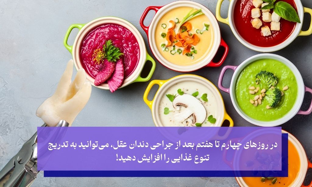 روزهای چهارم تا هفتم، برای جراحی دندان عقل چی بخوریم