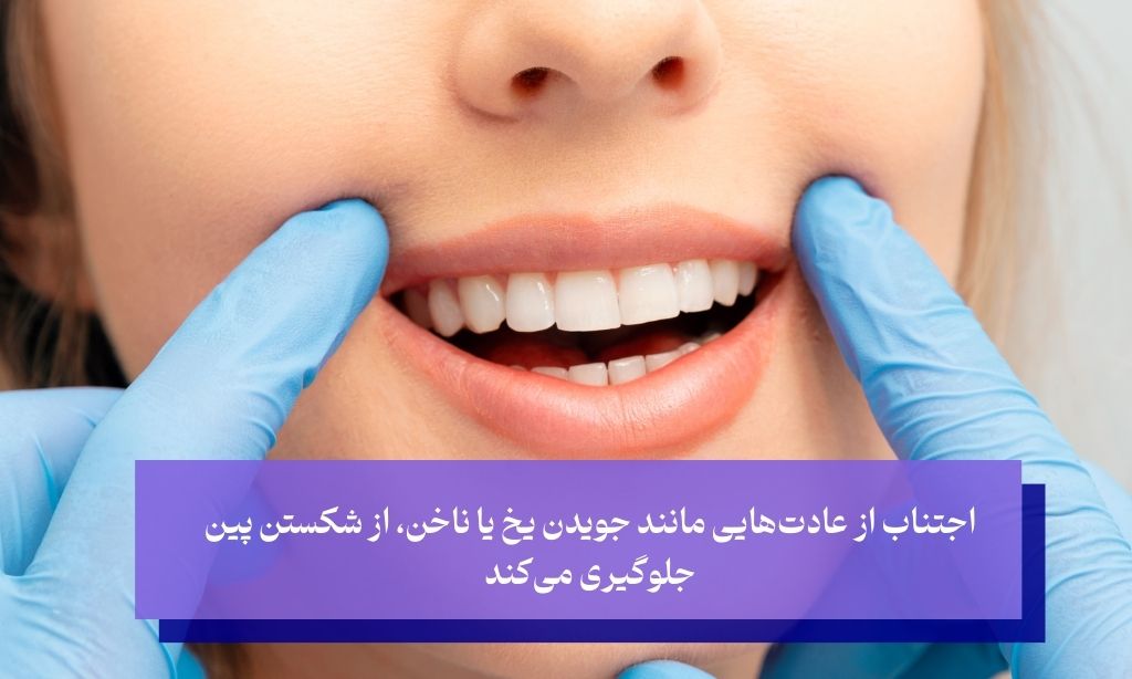 چگونه از دندان‌های دارای پین مراقبت کنیم