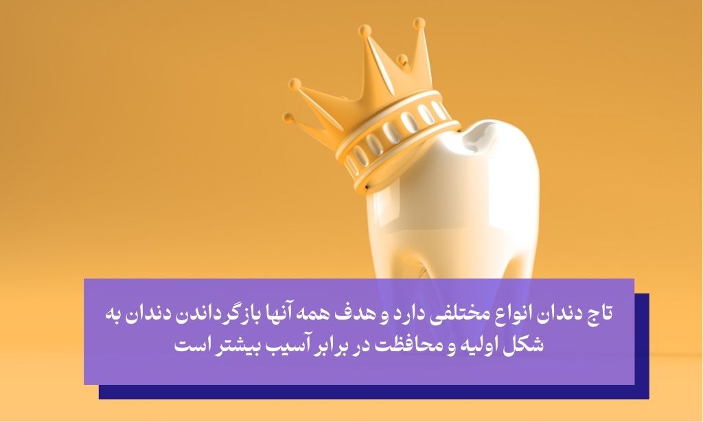 تعریف روکش یا تاج