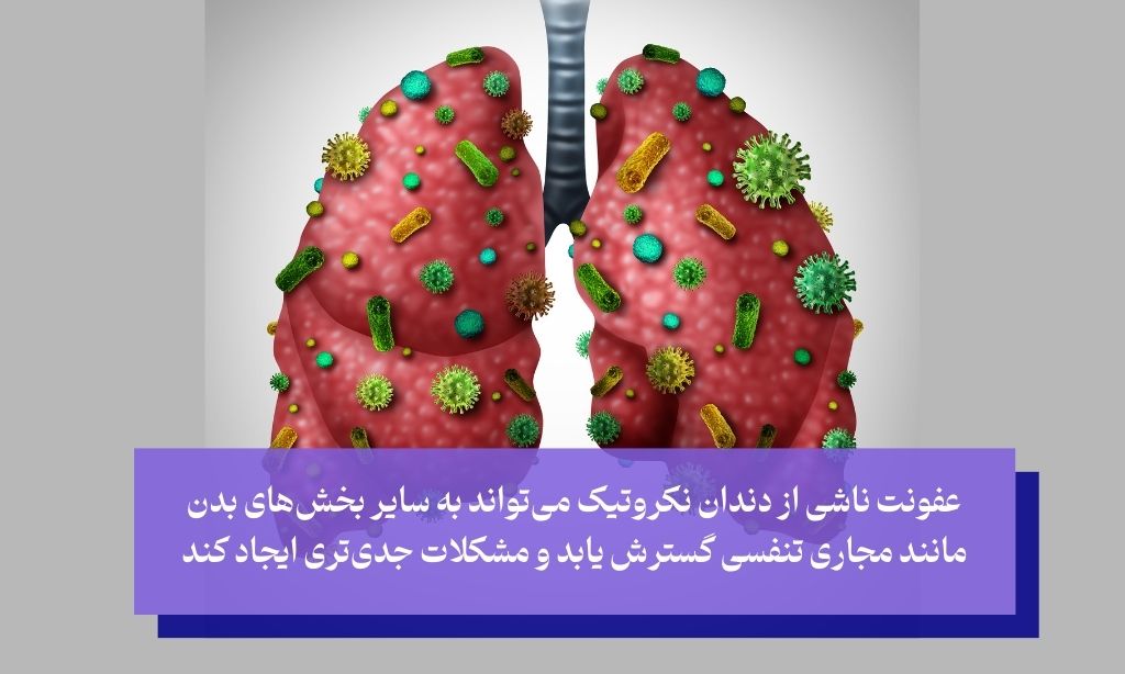 تأثیر نکروز دندان بر سلامت عمومی بدن