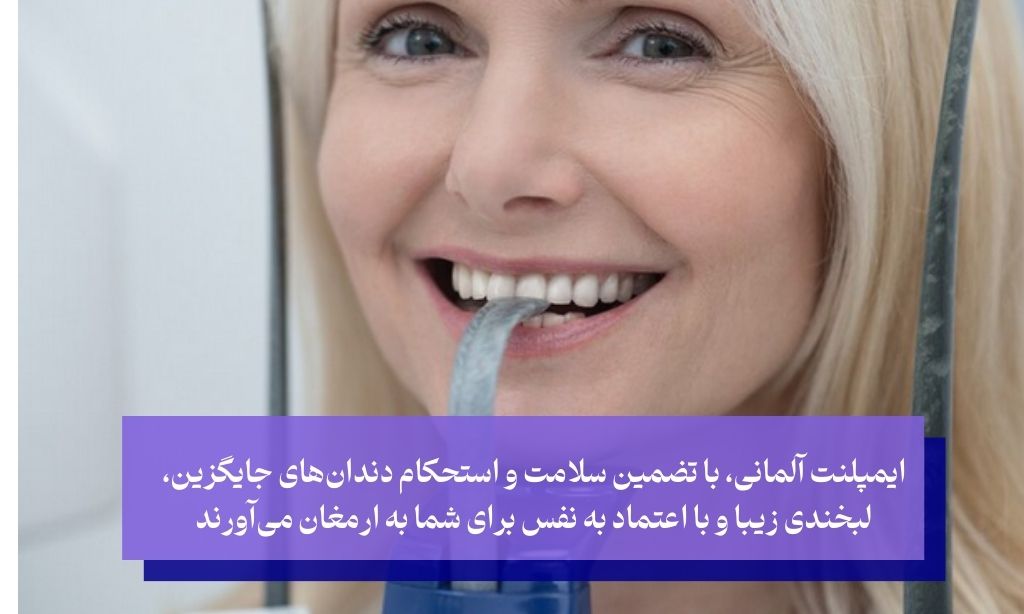 ایمپلنت آلمانی؛ سرمایه‌گذاری برای یک عمر لبخند زیبا