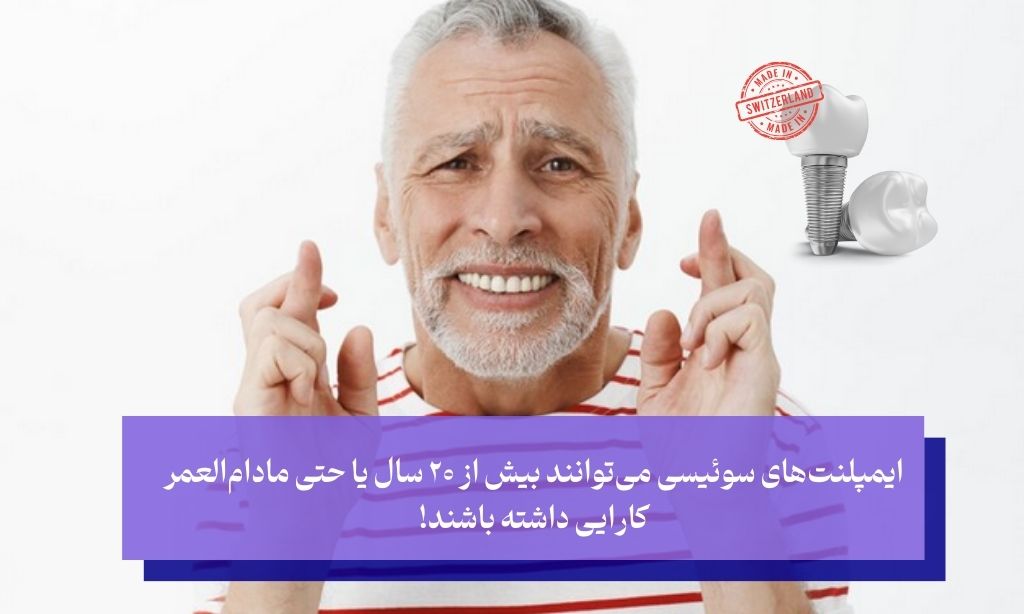 طول عمر ایمپلنت سوئیسی