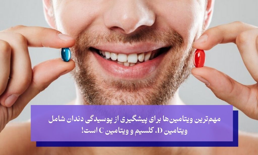 کمبود کدام ویتامین باعث پوسیدگی دندان میشود؟